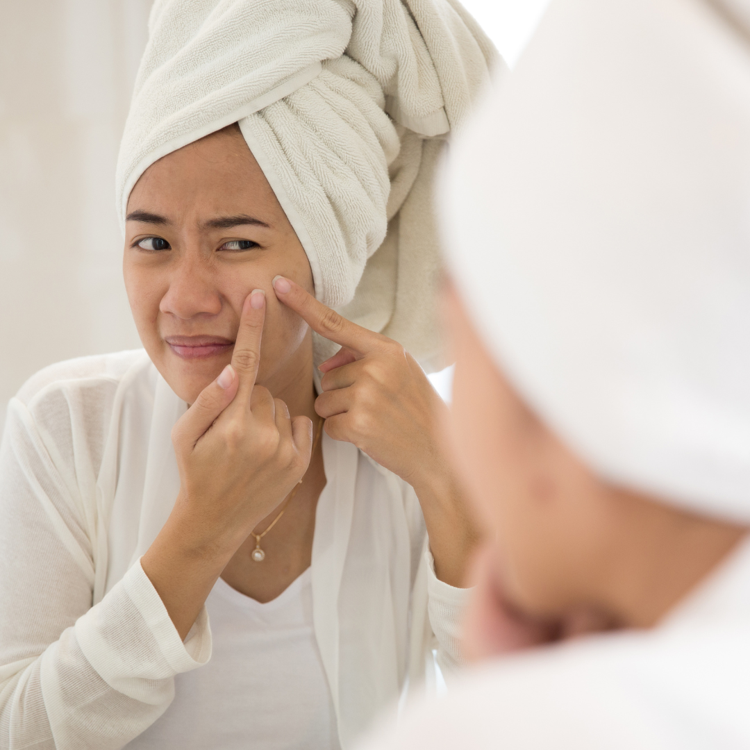 The Role of Diet and Probiotics in a New Approach to Treating Acne