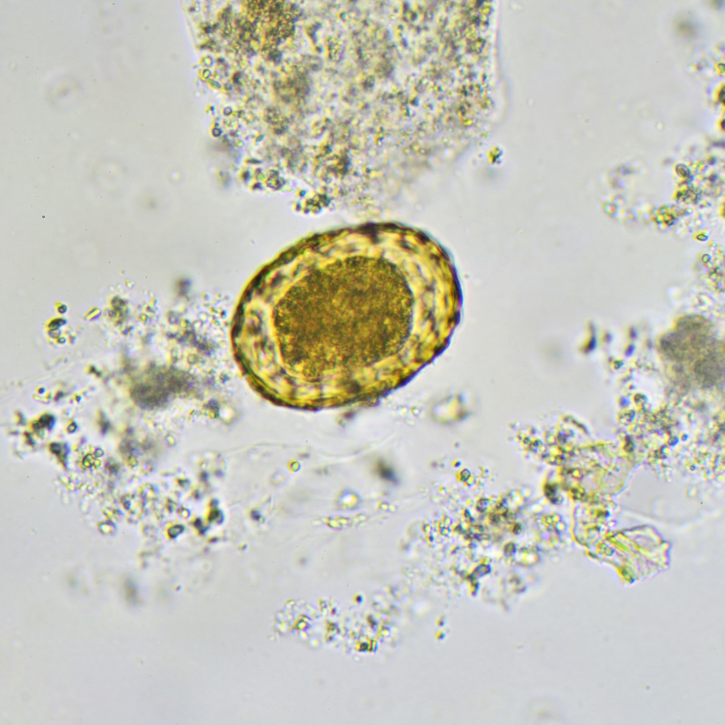 Treating Parasitic Infections the Right Way