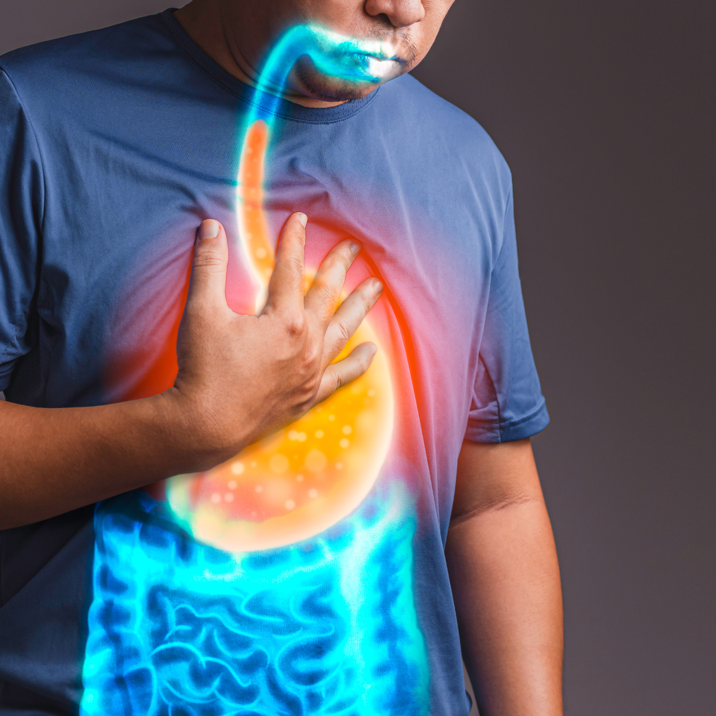 How to Treat Acid Reflux Naturally Part 1