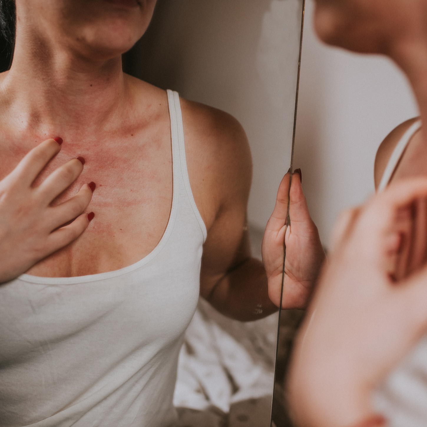 Eczema and Your Gut (part 1): The Hidden Link That Could Transform Your Skin
