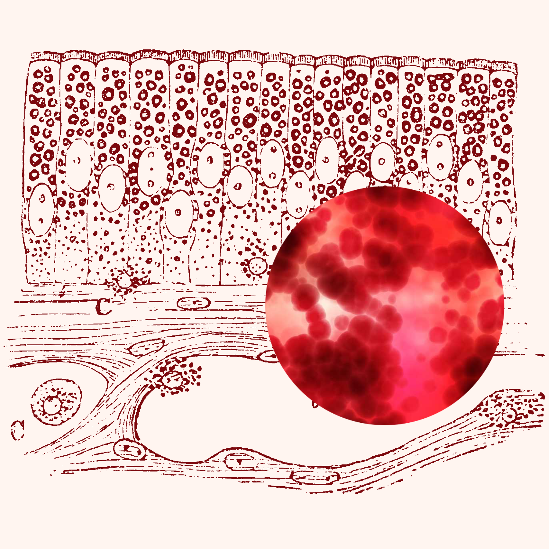 8 Remedies for Gut Inflammation