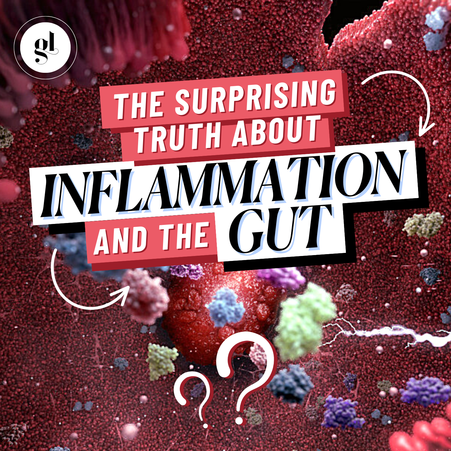 The Surprising Truth About Inflammation and the Gut