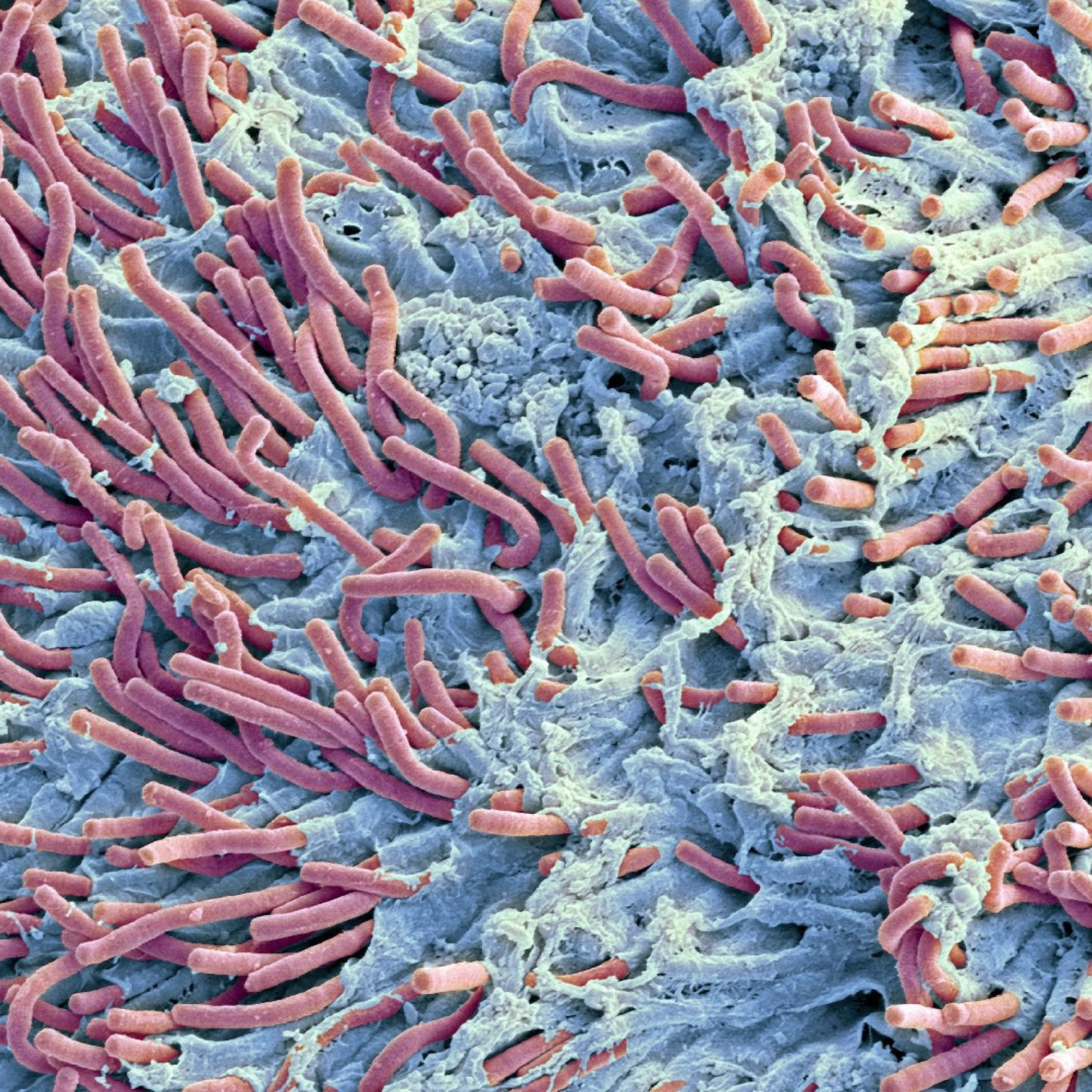 Biofilms: The Fortress your Bad Bacteria Built — and How to Tear it Down