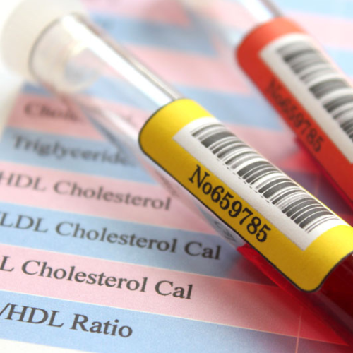The Lowdown on Cholesterol