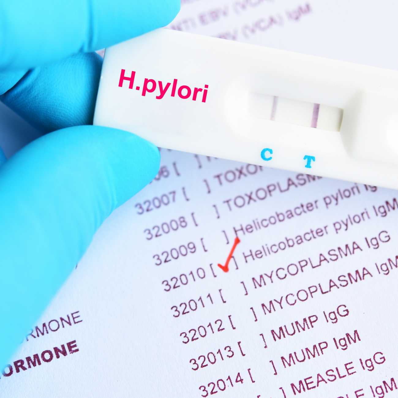 Tackling H. Pylori Naturally Part 1