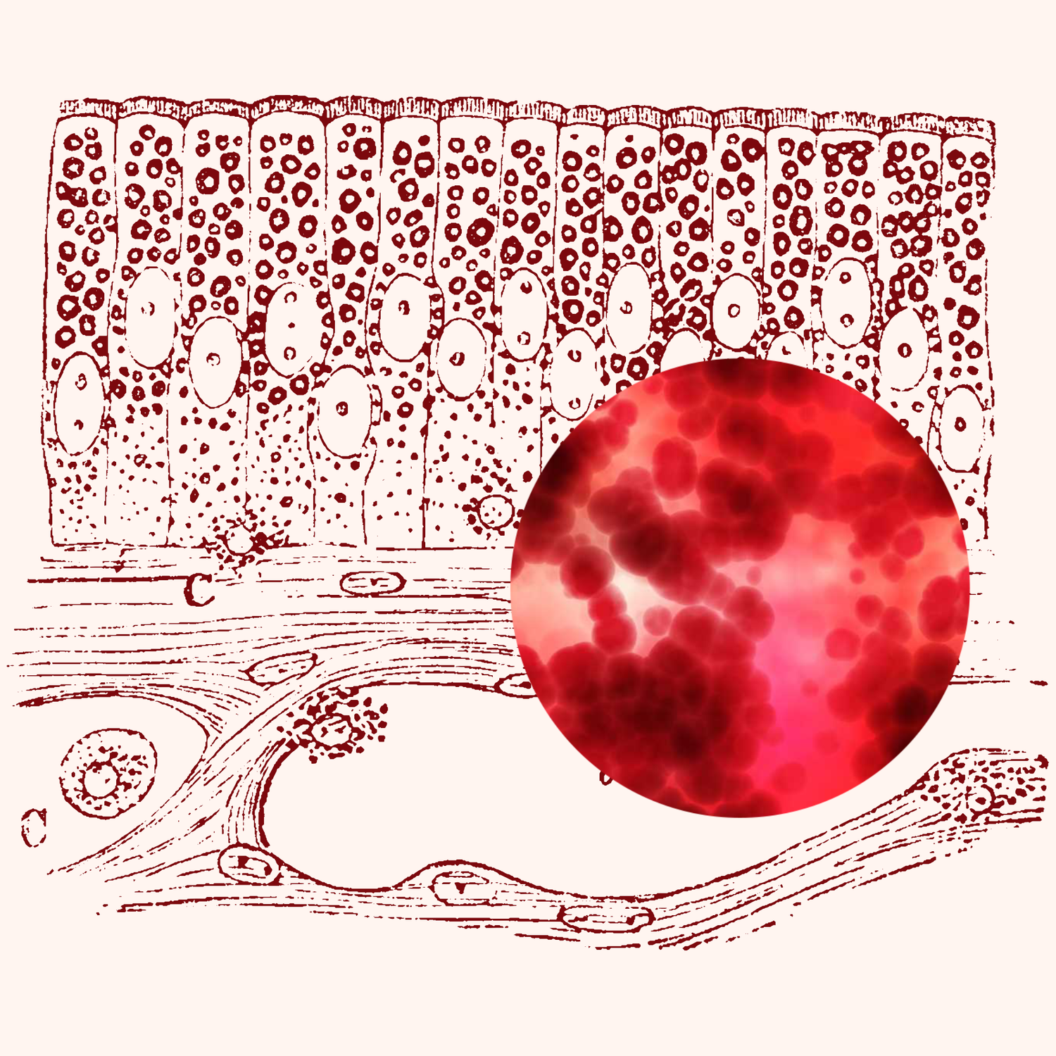 8 Remedies for Gut Inflammation